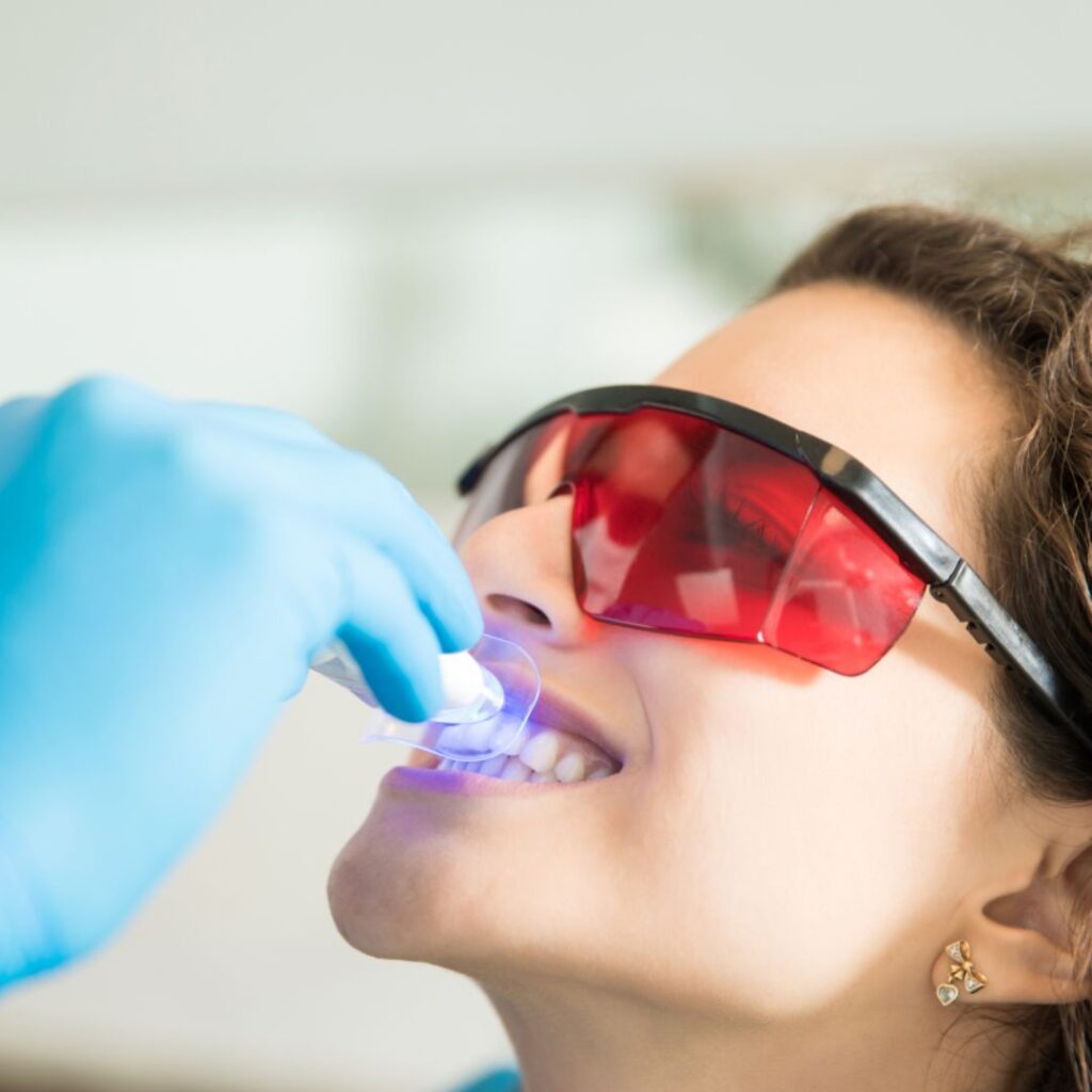 blanqueamiento-dental-clinica-nagua-dental