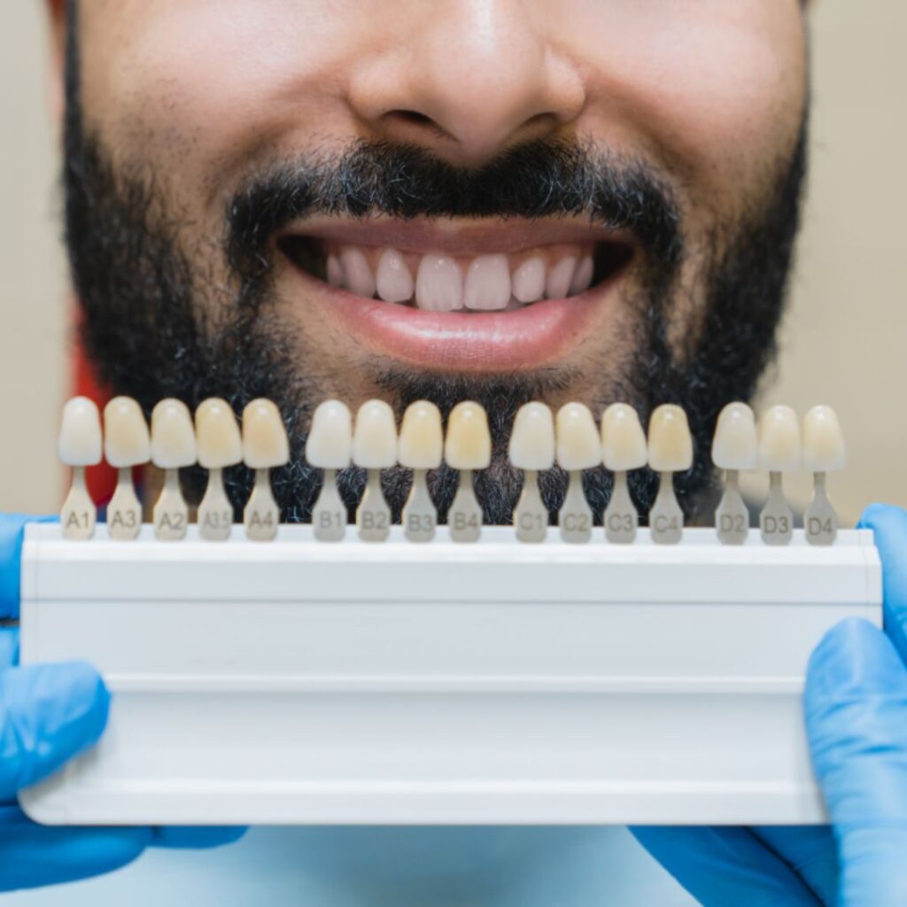 carillas-dentales-clinica-dental-nagua